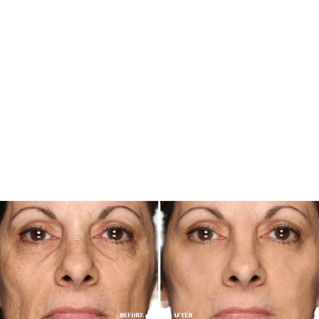 Antiox Cream A.M. - MEDWHOLESALE