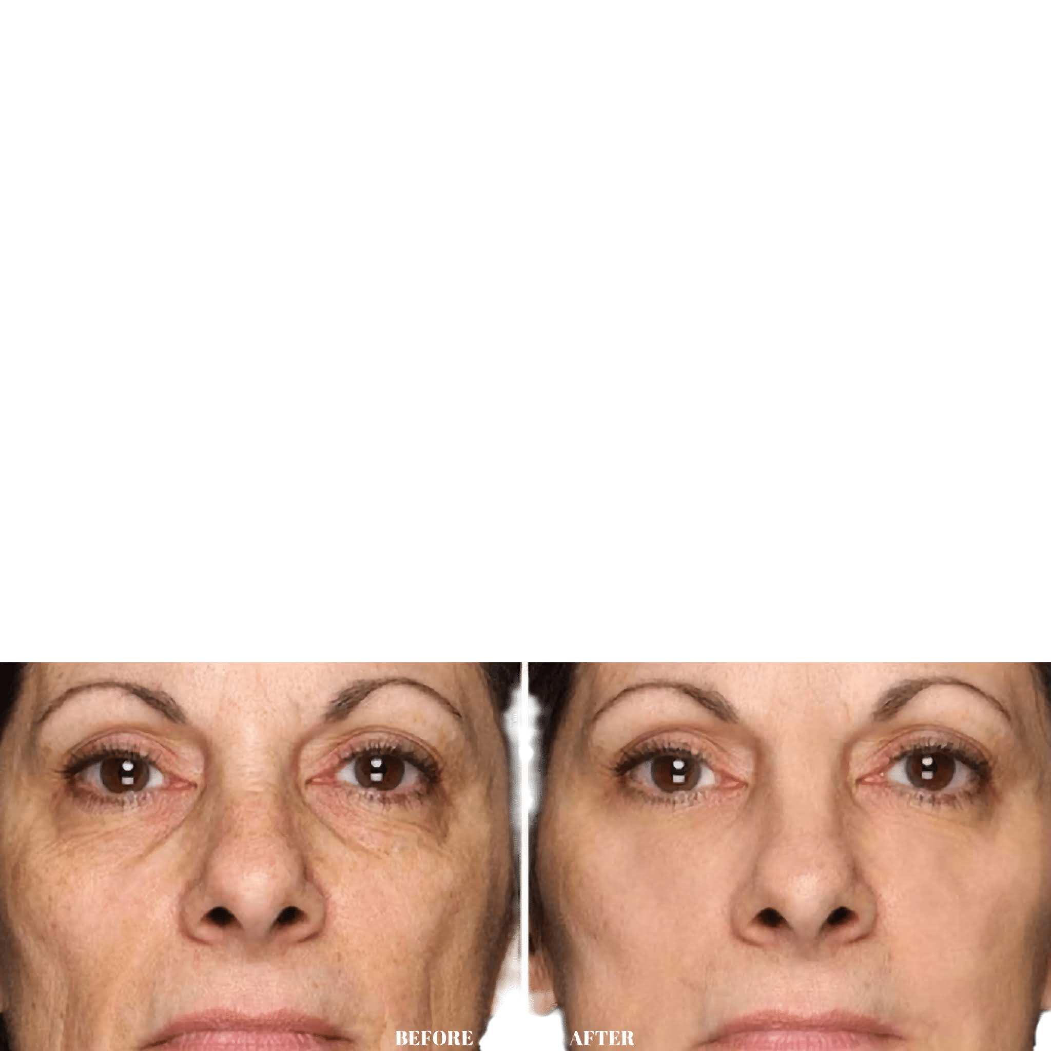 Antiox Cream A.M. - MEDWHOLESALE