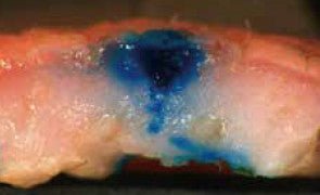 QUATRON NEEDLES 31G/0.26MM - MEDWHOLESALE